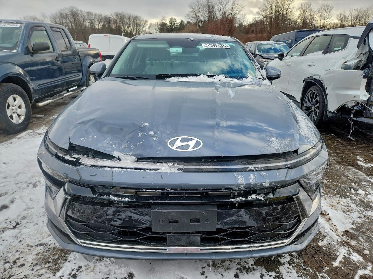 Hyundai SONATA Sel Image 2